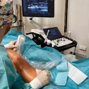  MINIINVAZIVNÍ LÉČBA KŘEČOVÝCH ŽIL